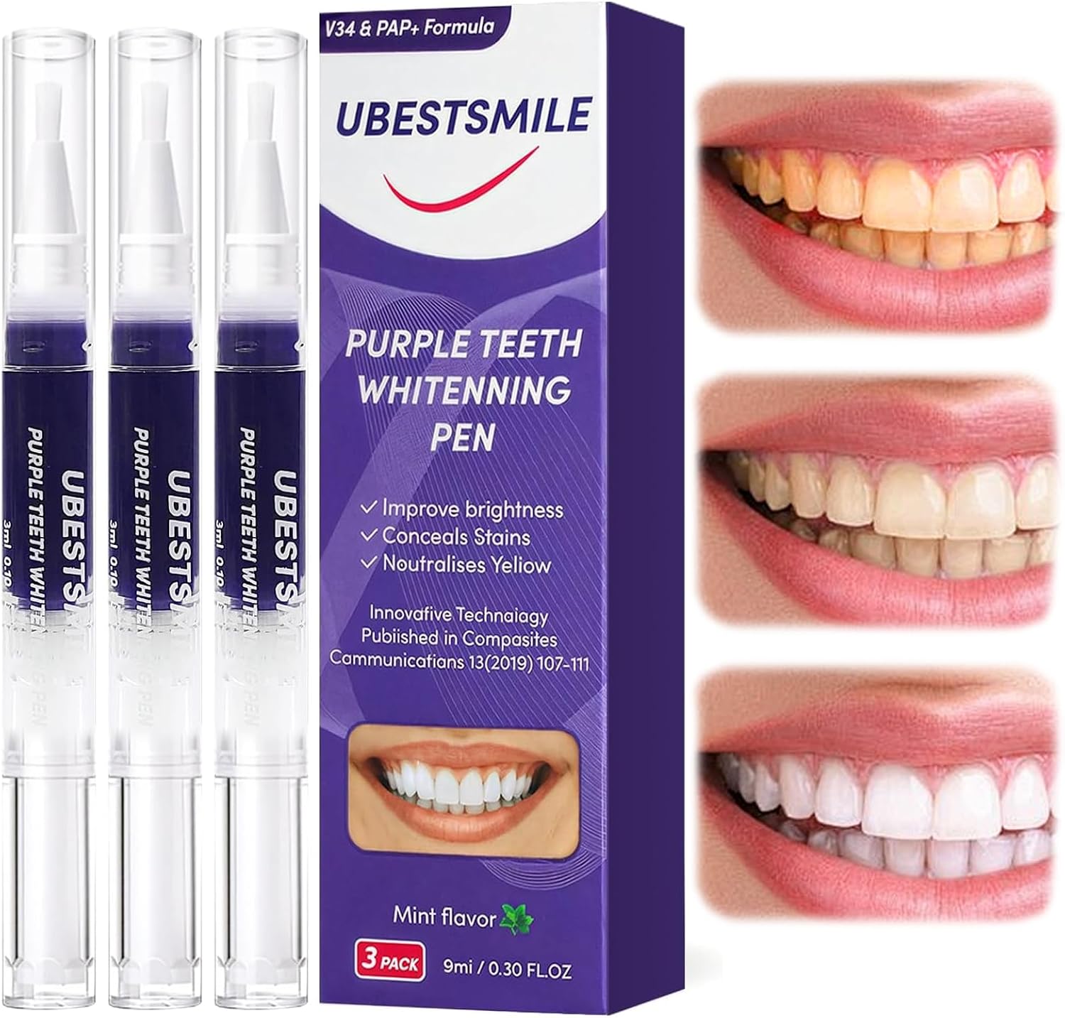 Teeth Whitening Pens - UBESTSMILE V34&PAP+ Фиолетовый отбеливающий карандаш для