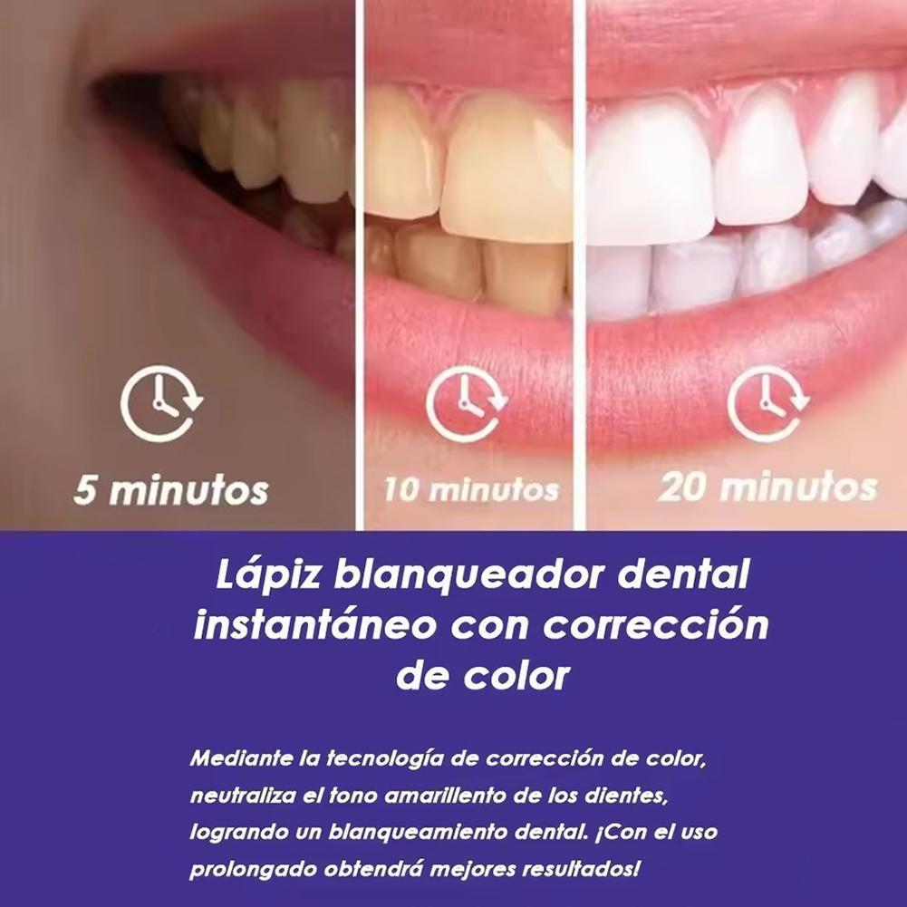 UBESTSMILE V34&PAP+ Фиолетовый – обзор и цена Teeth Whitening Pens