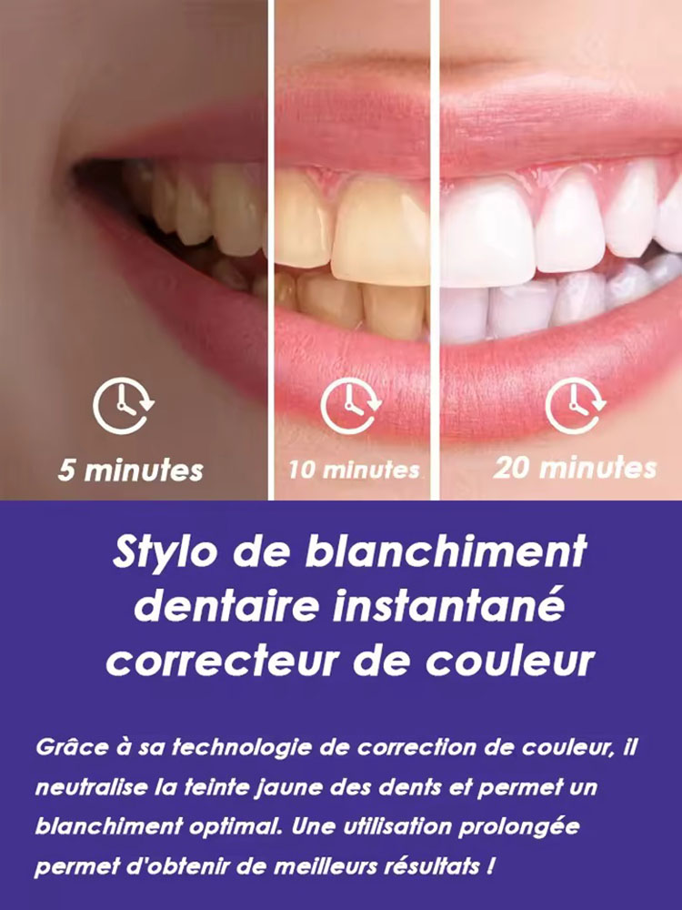 Набор из 2-х гелевых ручек для – обзор и цена Teeth Whitening Pens