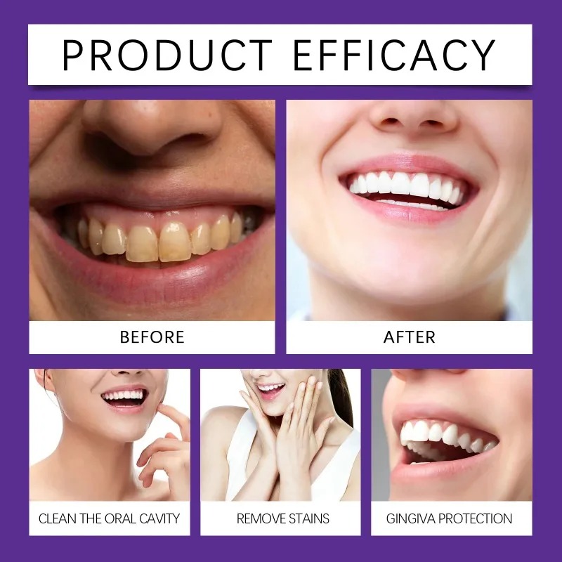 Минеральный порошок для восста – обзор и цена Teeth Whitening Near Me
